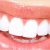 teeth-whitening.jpg